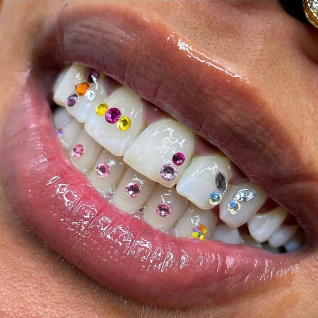 tooth gems in ikeja
